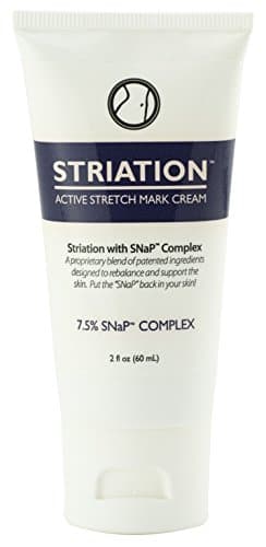 Striation Active Stretch Mark Cream - Clinically Tested To Reduce Stretch Marks, Scars and Varicose Veins. Target Your Stomach, Arms, Butt and Thighs