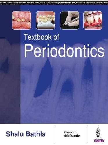 Textbook Of Periodontics