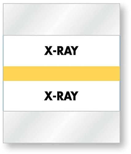 United Ad Label X-Ray Divider Tab, 1-1/2" x 1-1/4", Tan - 100 Tabs Per Pack