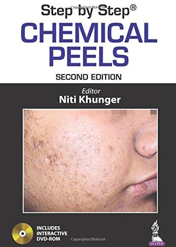 Step By Step Chemical Peels with DVD-ROM