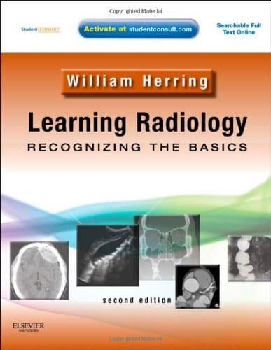 By William Herring - Learning Radiology: Recognizing the Basics (With STUDENT CONSULT Online Access): 2nd (second) Edition