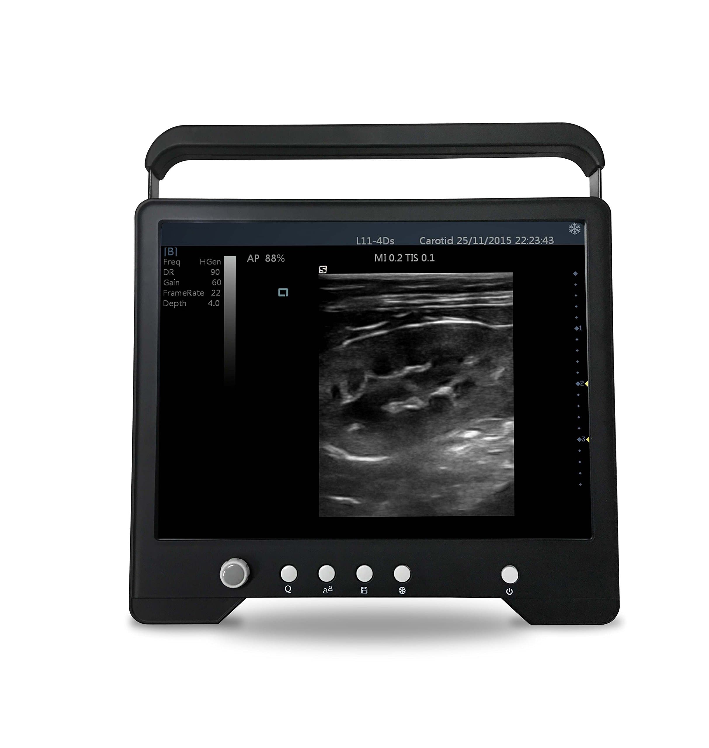Veterinary Tablet Touchscreen Ultrasound with one Rectal Probe