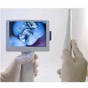 PatientView All-In-One Dental Camera + Display