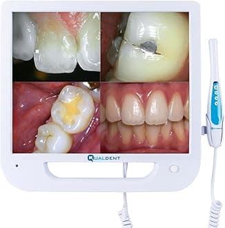 Qualdent Intraoral Camera with 17-inch HD Screen – 10 MP Dental Camera, CMOS Sensor, 6 High-Intensity LED Lights, Auto Focus 5-50mm, 256GB Storage