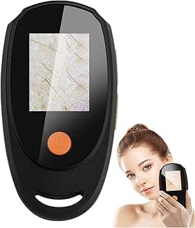 Dermatoscope Scalp Camera, Skin Analysis Machine, Handheld 2-in-1 Observer fo...