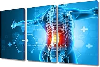 3 Panel Human Backache and Back Pai Poster Pictures for Bedroom Medical Health Care Concept Wall Decoration for Living Room Giclee Wooden Framed Gallery-Wrapped Ready to Hang 36" Wx24 H