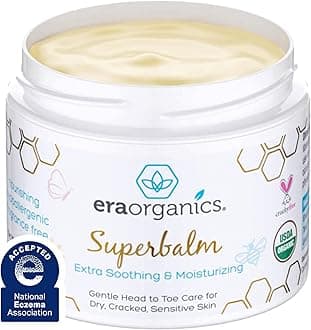 Era Organics Healing Ointment for Babies USDA Certified Natural Healing Cream for Baby Eczema, Cradle Cap (Infant Seborrheic Dermatitis), Chapped Nose, Rashes, Hives & More 2oz