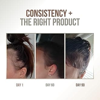 Premium Batana oil for Hair Growth |100% Raw Elaeis Oleifera for Natural Scalp Care | Dr Sebi Hair Shine treatment for Men & Women | Natural Cold Pressed Extraction Method | Liquid Formula