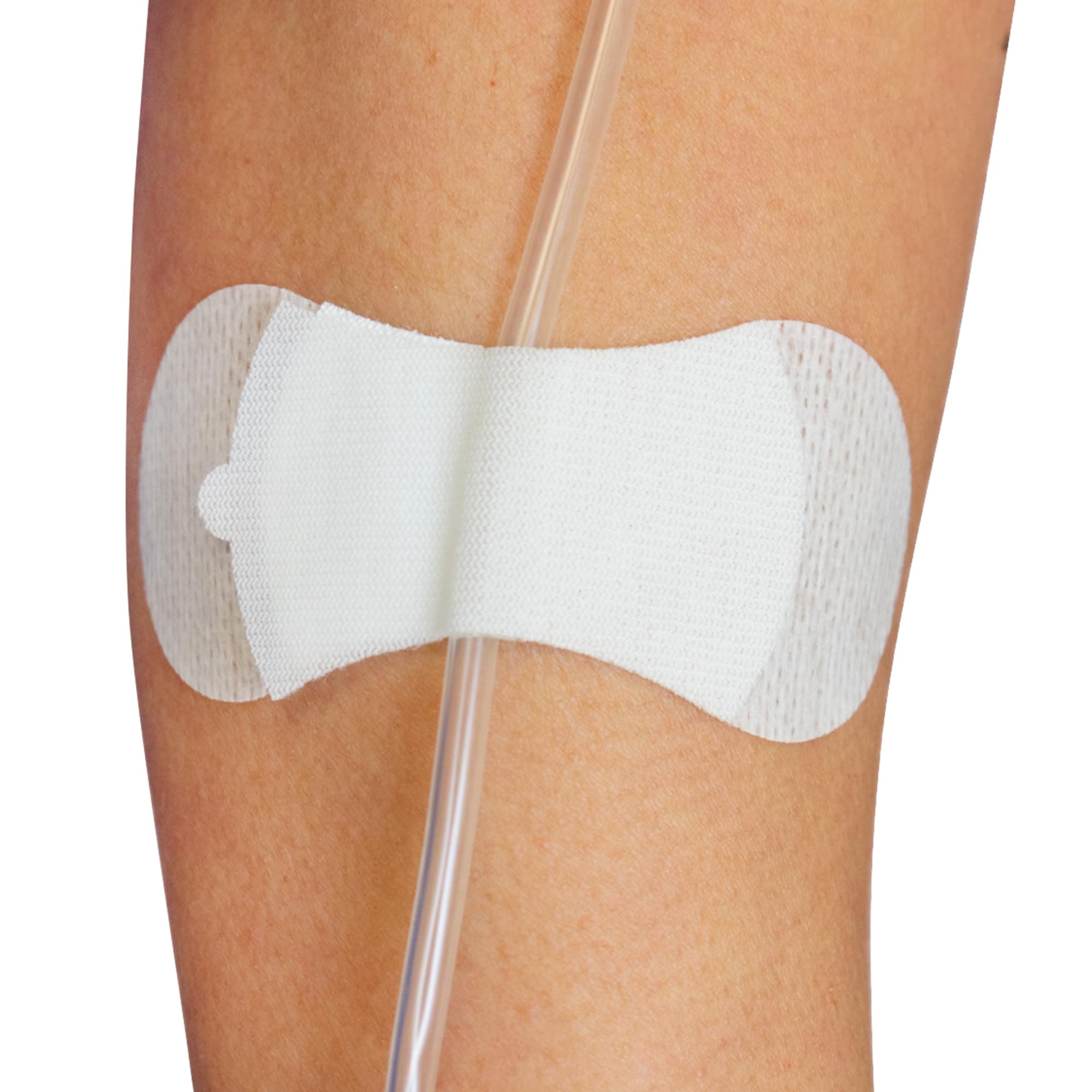 TIDI 3300M-10PK Grip-Lok Medium Securement Device ― Pack of 10 ― Catheter Stabilization Device ― White ― Flexible Material ― Low-Profile Design for Comfort― Home Healthcare ― Medical Supplies