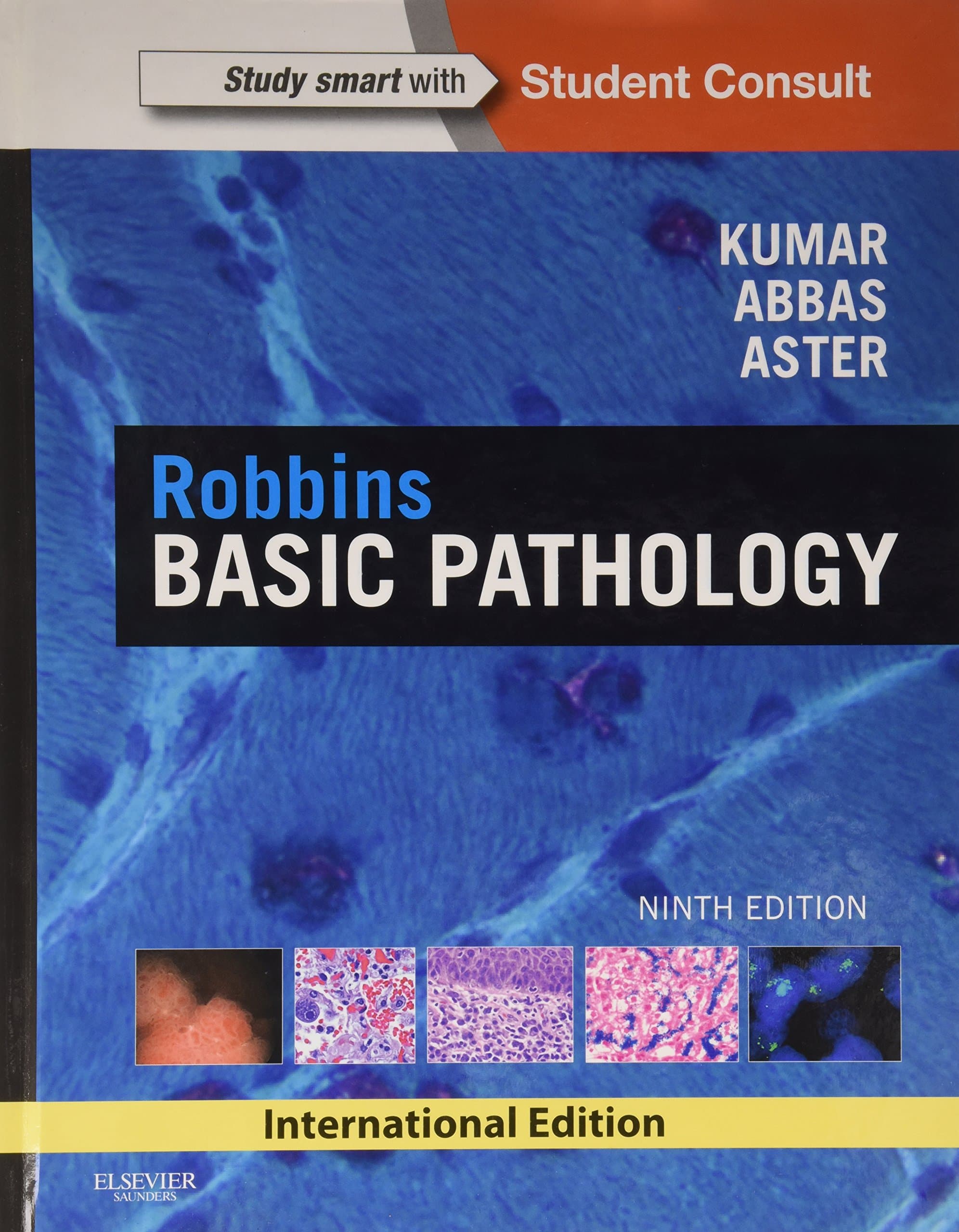 Robbins Basic Pathology